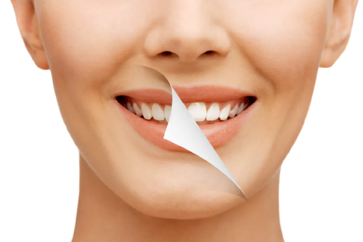 Are Your Teeth Not Responding to Whitening Toothpaste? What a Dentist Can Do Instead